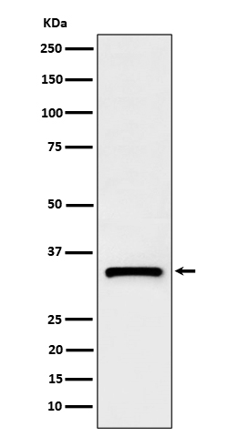 Complement C1q binding protein Ab