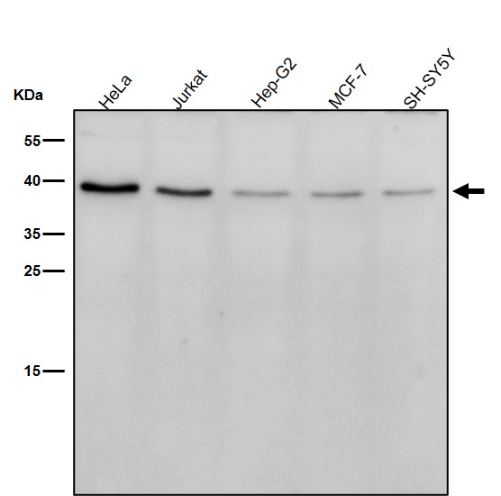 Nkx 2.1 Ab