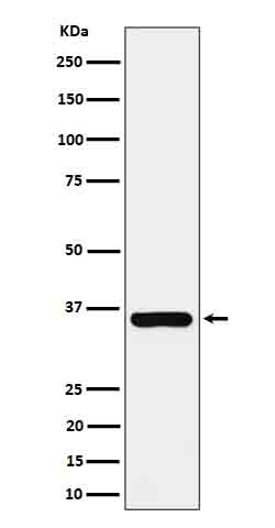 gamma Glutamyl hydrolase Ab