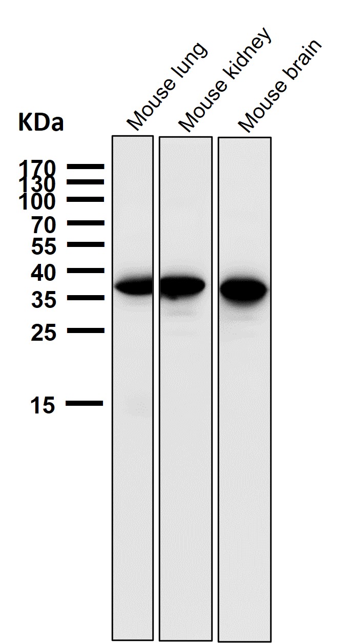 gamma Glutamyl hydrolase Ab