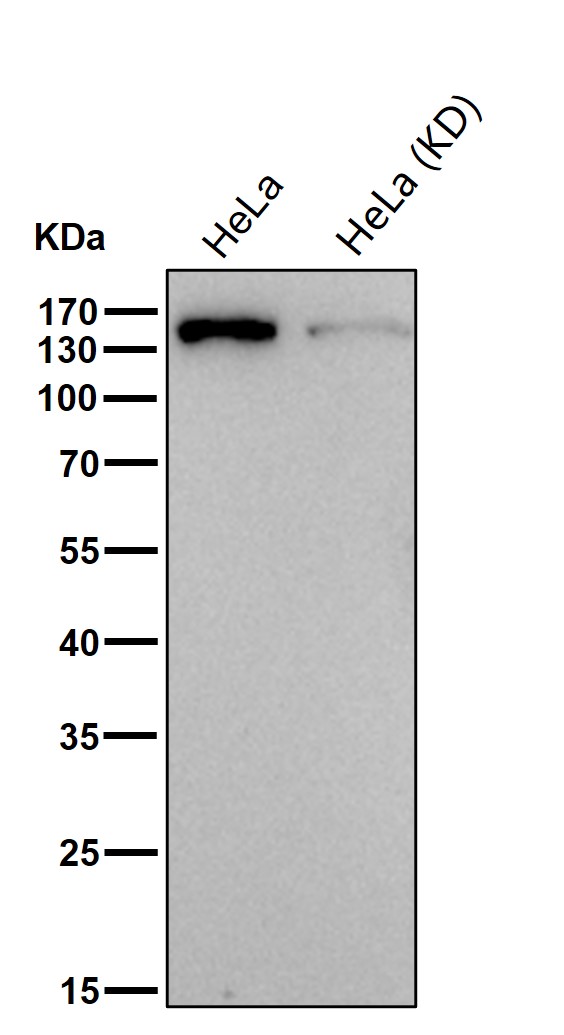 Condensin complex subunit 1 Ab