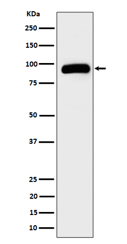 TRPV5 Ab