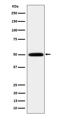 Histidine tRNA ligase Ab