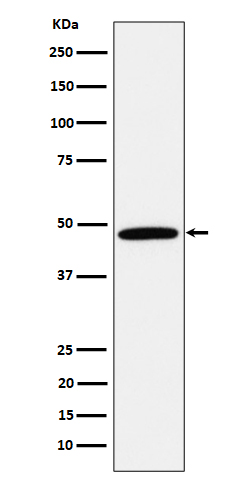 Calumenin Ab