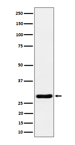 Calcipressin 1 Ab