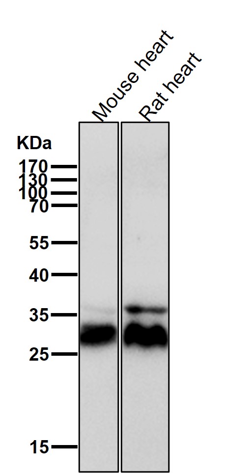 Calcipressin 1 Ab