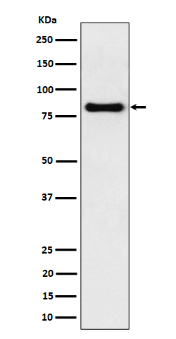 Scinderin Ab