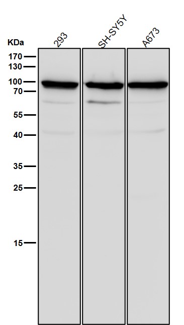 Scinderin Ab