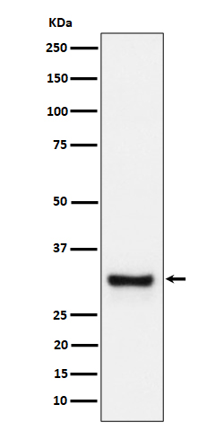 Adiponectin Ab