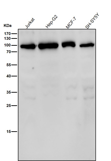 GFPT1 Ab