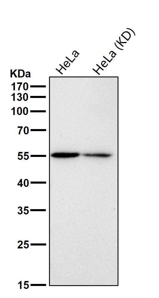 p60 Katanin Ab