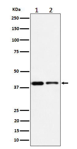 SLP 2 Ab