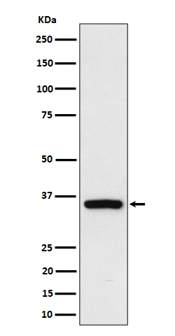 RAD51D Ab