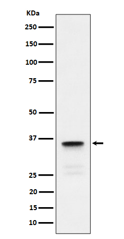 LDHC Ab