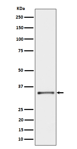 Cytochrome b5 reductase Ab