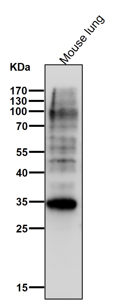 Cytochrome b5 reductase Ab