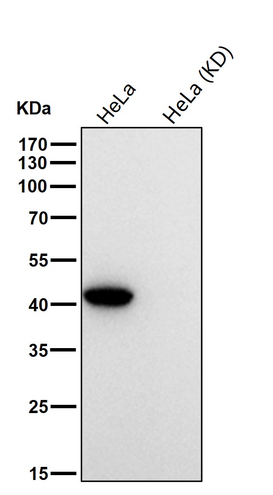 Mevalonate kinase Ab