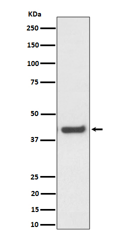 Mevalonate kinase Ab