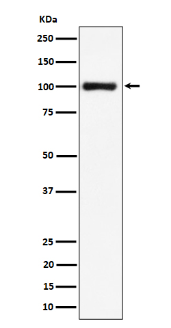 NCL Ab