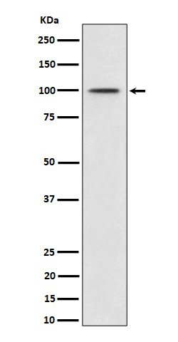 p-MDM2 (S166) Ab