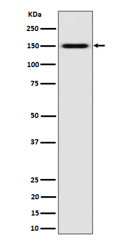 SLC12A1 Ab