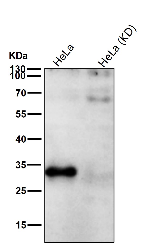 Inorganic pyrophosphatase Ab