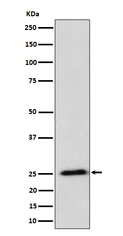 RPL10A Ab