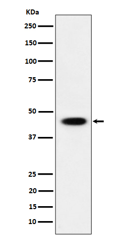 AdSS 2 Ab