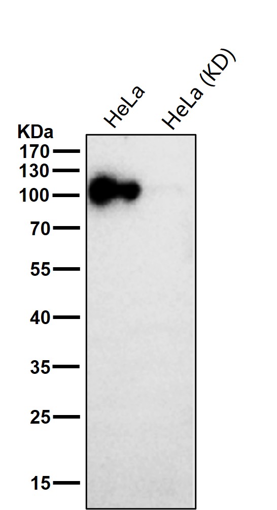 USO1 Ab