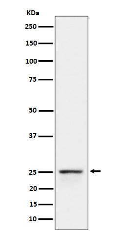 Peroxin 11B Ab