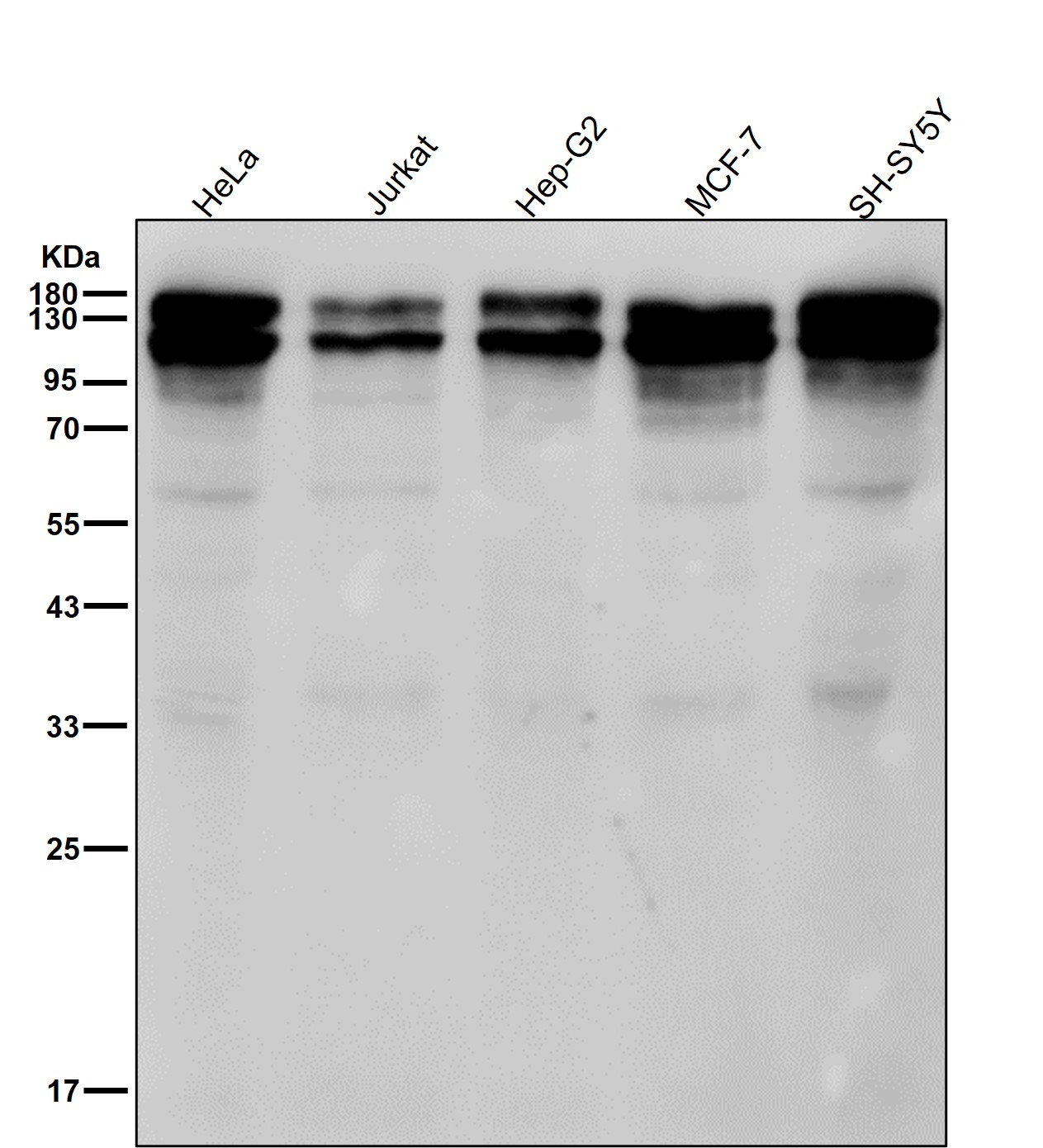 Nicastrin Ab