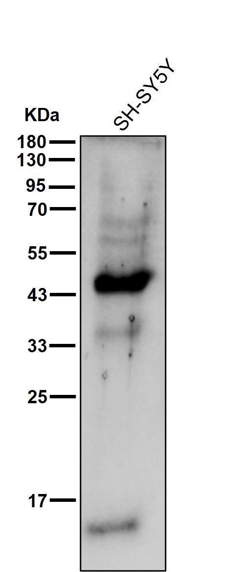 Cathepsin D Ab