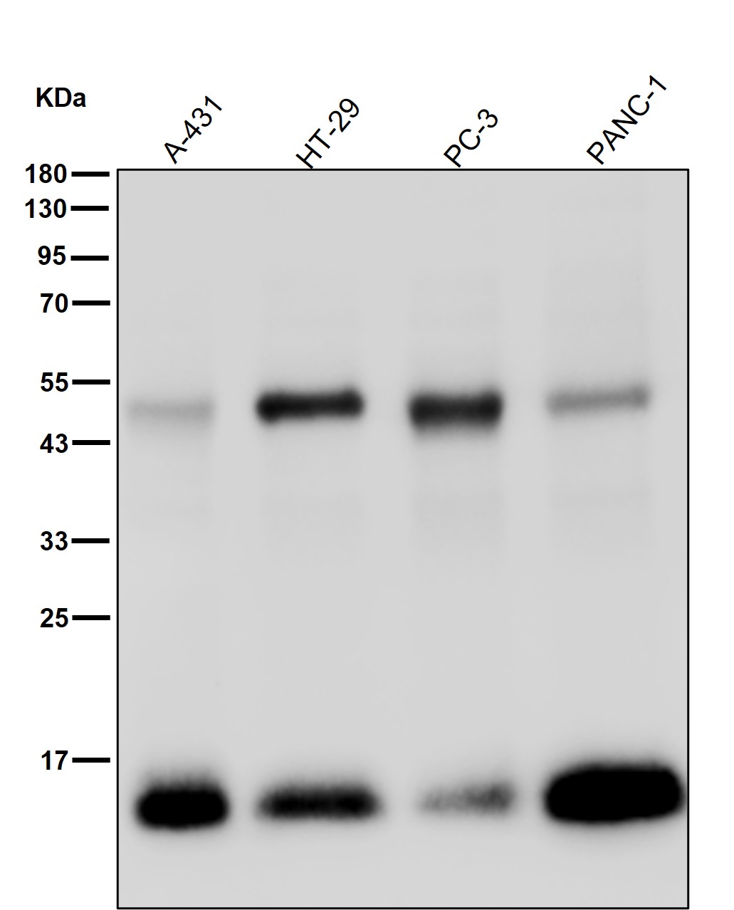 Cathepsin D Ab