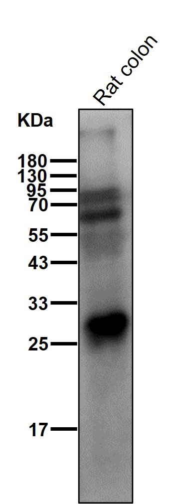 Complement C1q C Ab