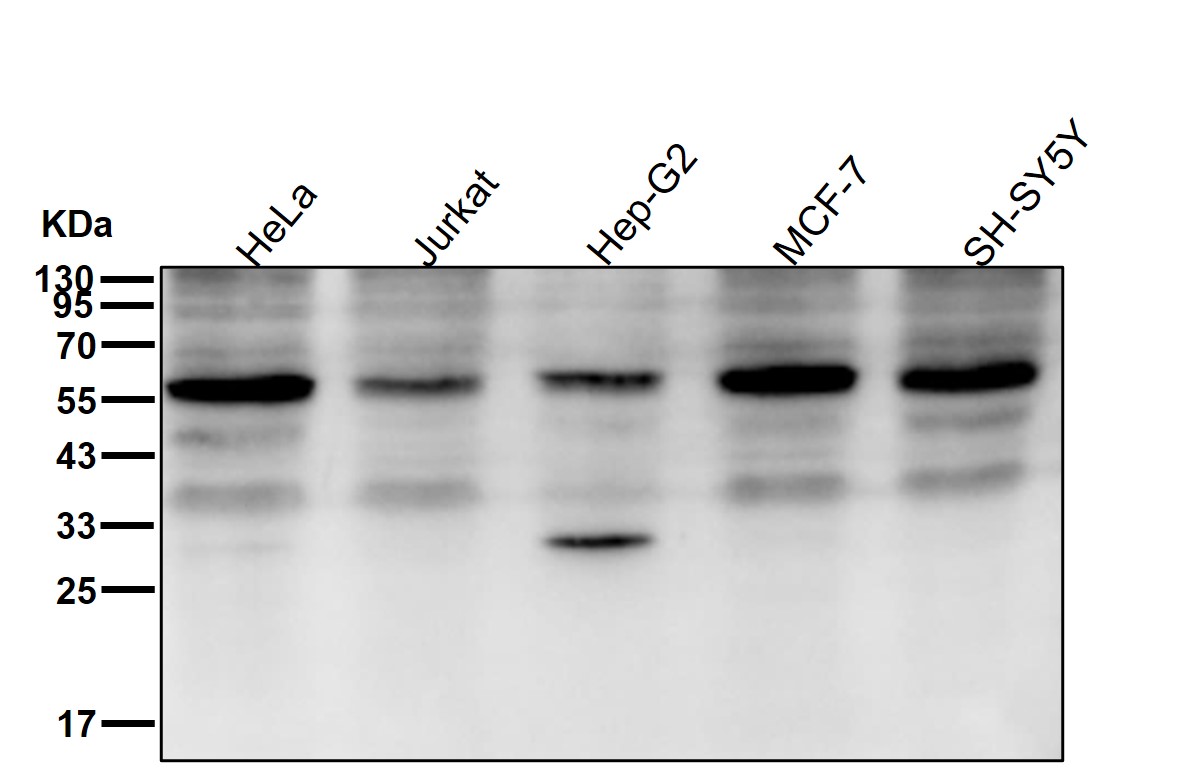 Acetylcholine receptor subunit beta Ab