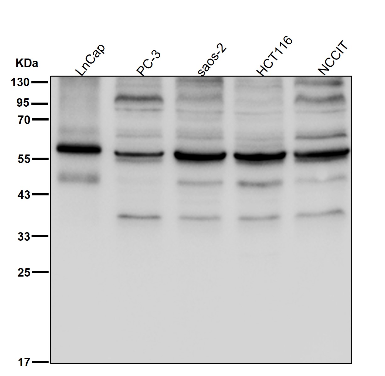 Acetylcholine receptor subunit beta Ab