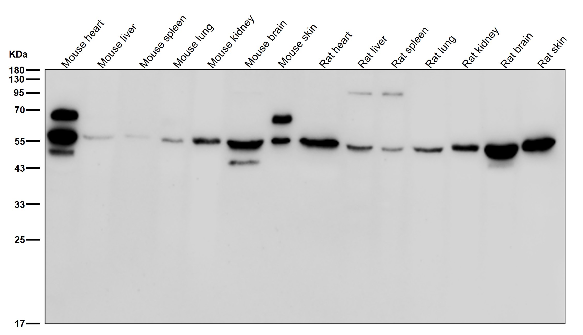 Acetylcholine receptor subunit beta Ab