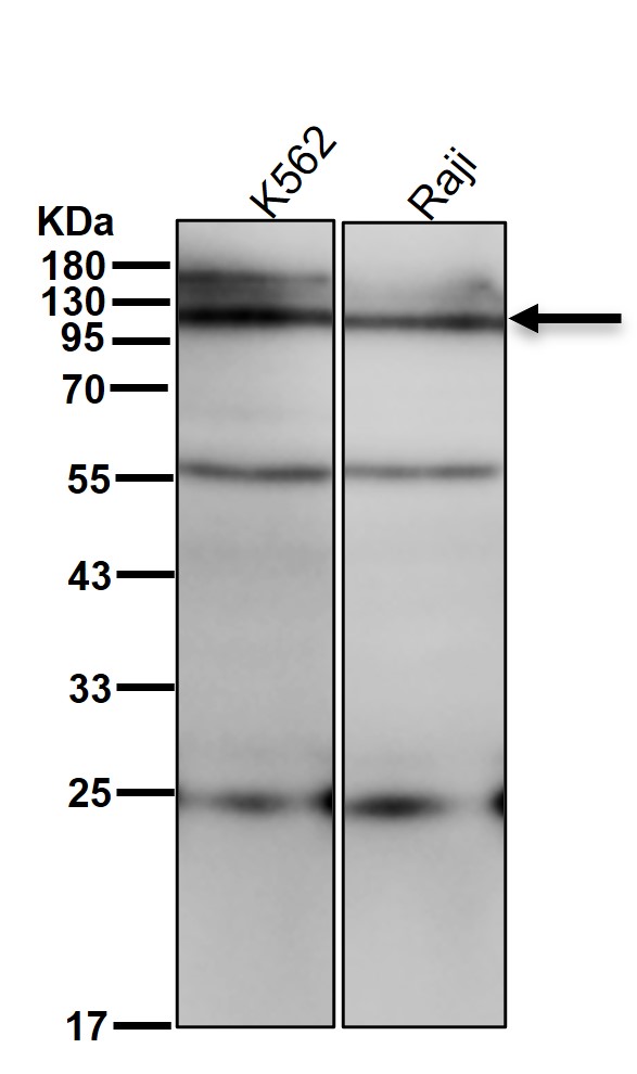 p-alpha Adducin (S59) Ab