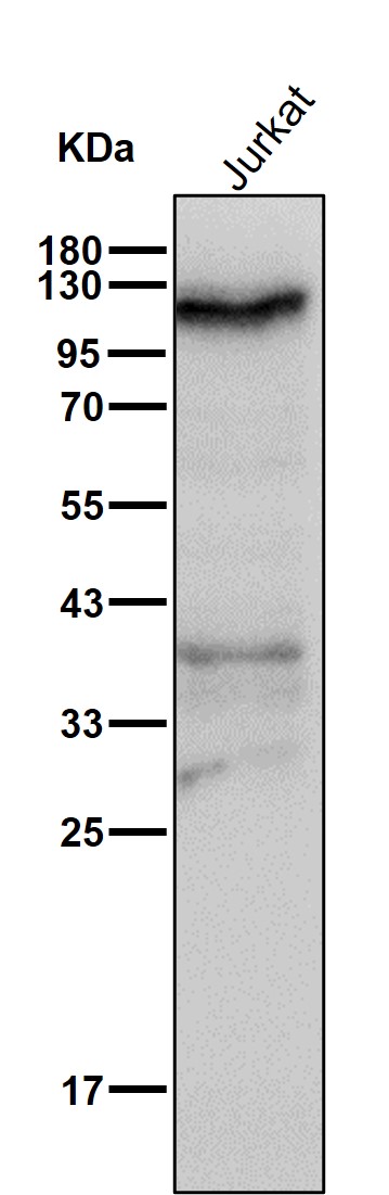 INPP4A Ab