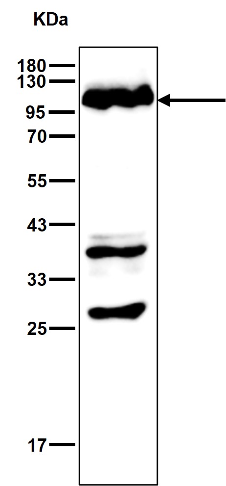 INPP4A Ab