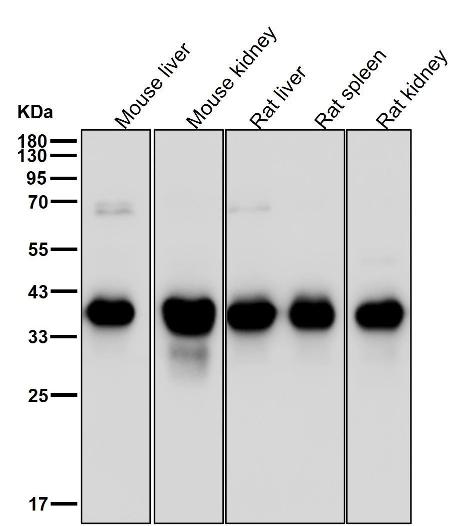 Aldolase B/C Ab