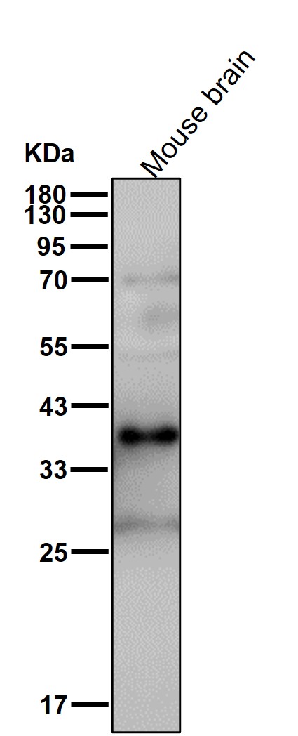 Aldolase B/C Ab