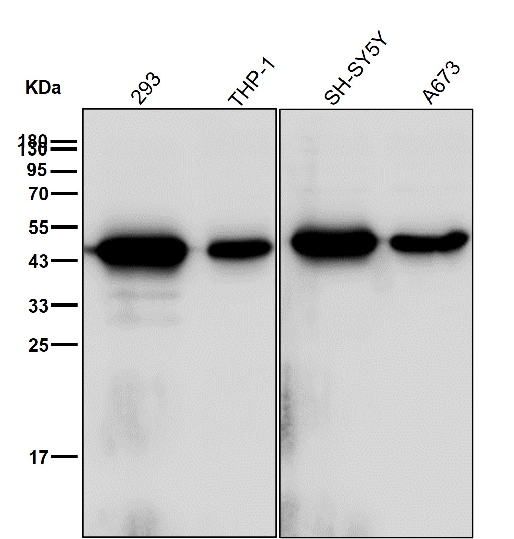 Creatine kinase B type Ab