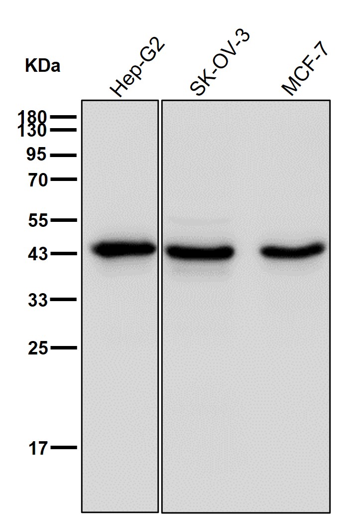 Creatine kinase B type Ab