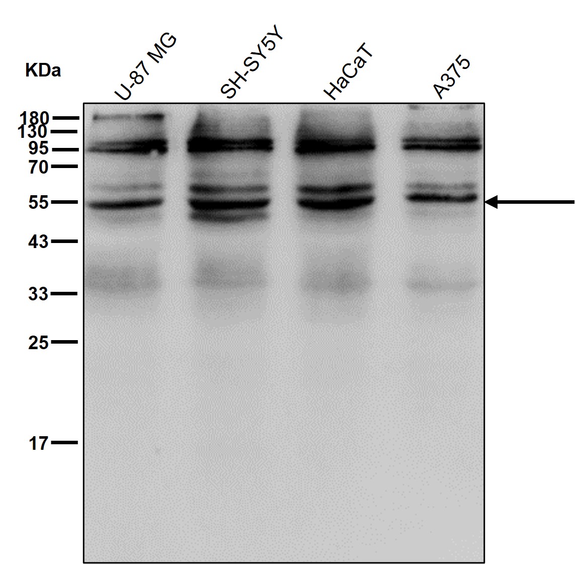 NTPDase 2 Ab