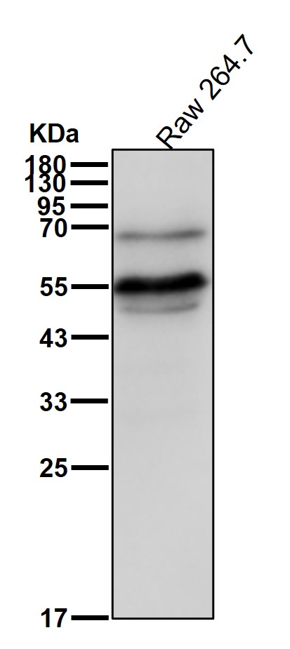 CD4 Ab