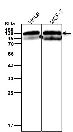 Focal adhesion kinase 1 Ab