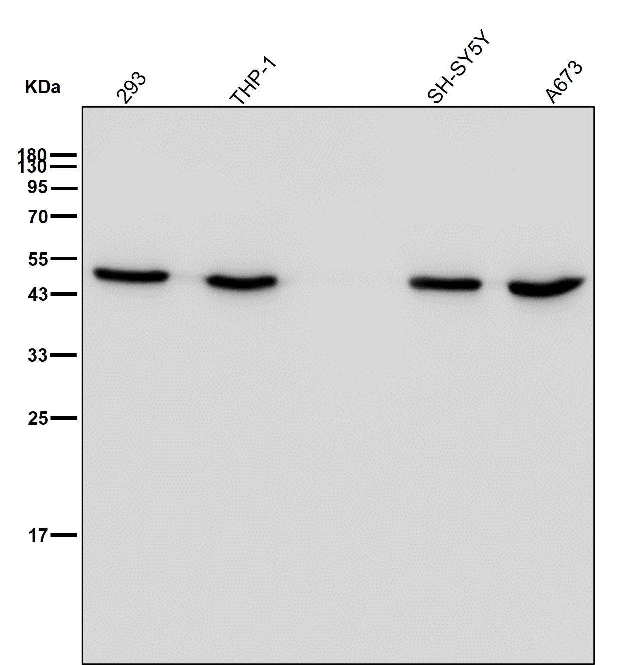 gamma Enolase Ab