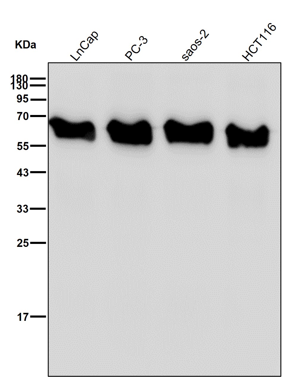 Calreticulin Ab