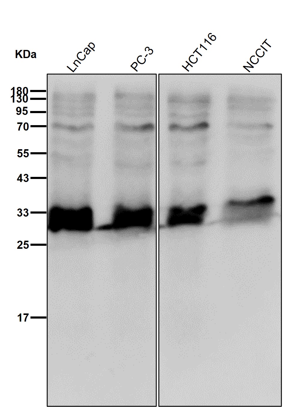 CDK4 Ab